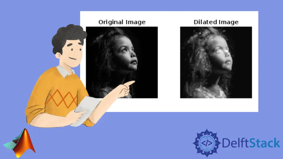 Dilatation d'image MATLAB